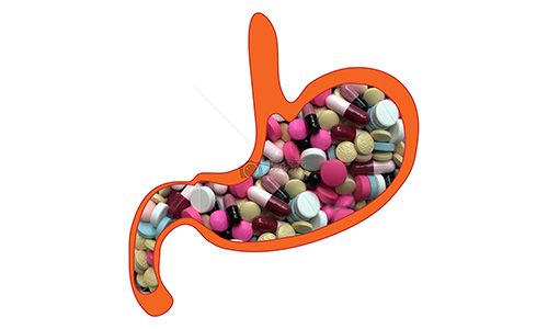 胃滯留技術(shù)